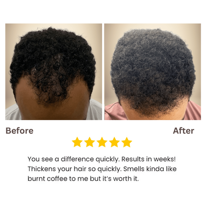 Bantana Natural Hair Growth Oil